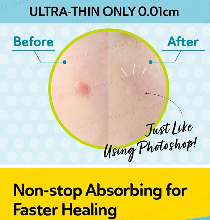 Day Use Salicylic Acid Acne Patch 24 pcs - Clearing - 12 pcs x 2