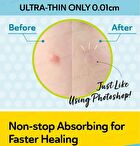 Day Use Salicylic Acid Acne Patch 24 pcs - Clearing - 12 pcs x 2