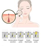 Daily Safe Black Head Clear Nose Pack Set - 11 pcs