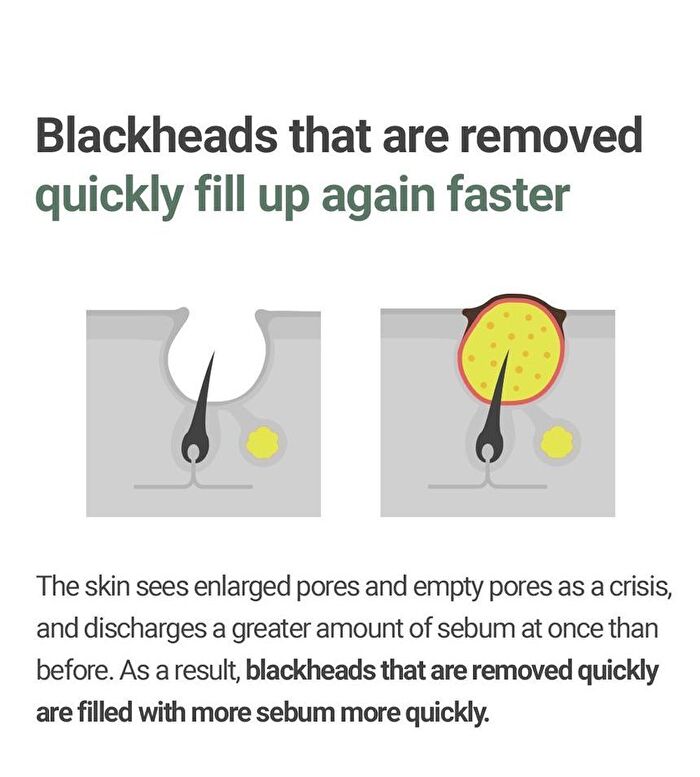 Daily Safe Black Head Clear Nose Pack Set - 11 pcs