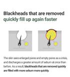 Daily Safe Black Head Clear Nose Pack Set - 11 pcs