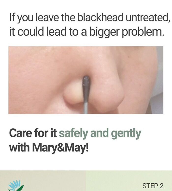 Daily Safe Black Head Clear Nose Pack Set - 11 pcs