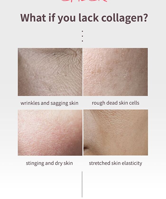 Mqny Collagen Vita Wrinkle Multi Balm - 10g