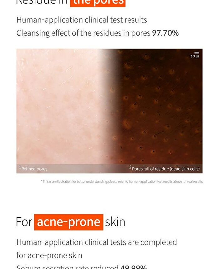 UnderPore Foam Cleanser - 150ml