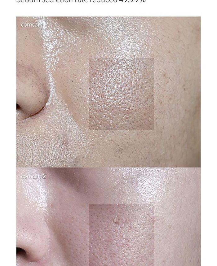 UnderPore Foam Cleanser - 150ml