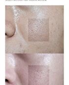 UnderPore Foam Cleanser - 150ml