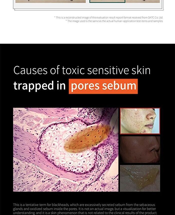 UnderPore Foam Cleanser - 150ml