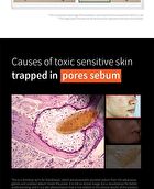 UnderPore Foam Cleanser - 150ml