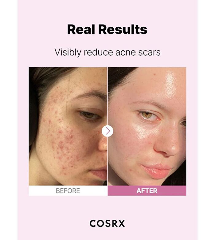 Cosrx The Niacinamide 15 Serum - 20ml