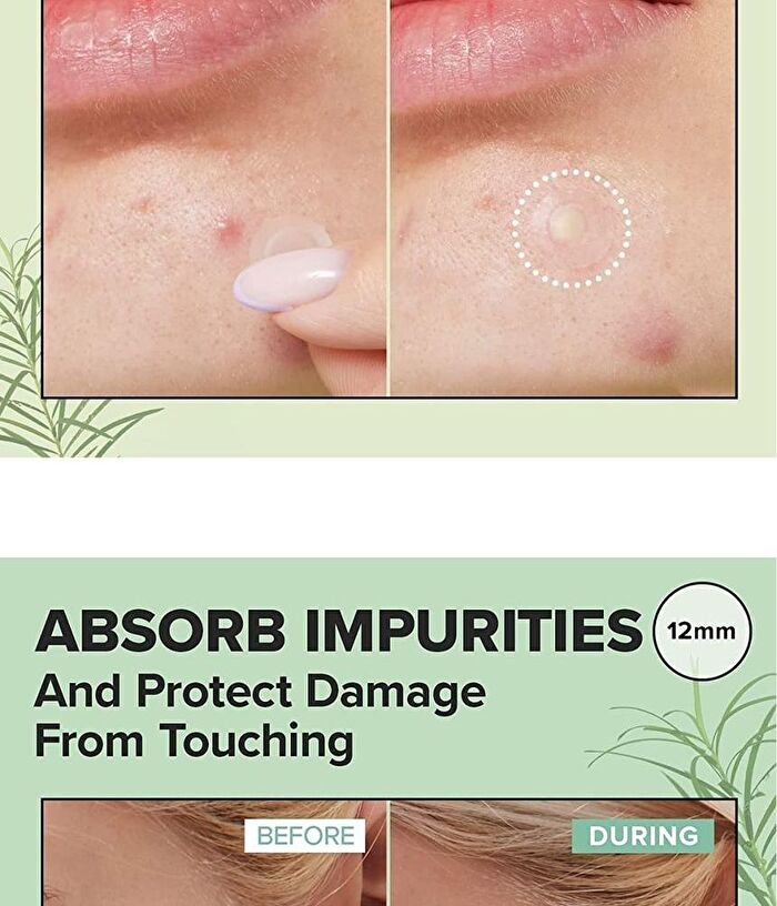 I Dew Care Timeout Blemish Patch  & Plus - 2 Types - Original