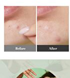 I Dew Care Timeout Blemish Patch Original &  - 2 Types - Plus