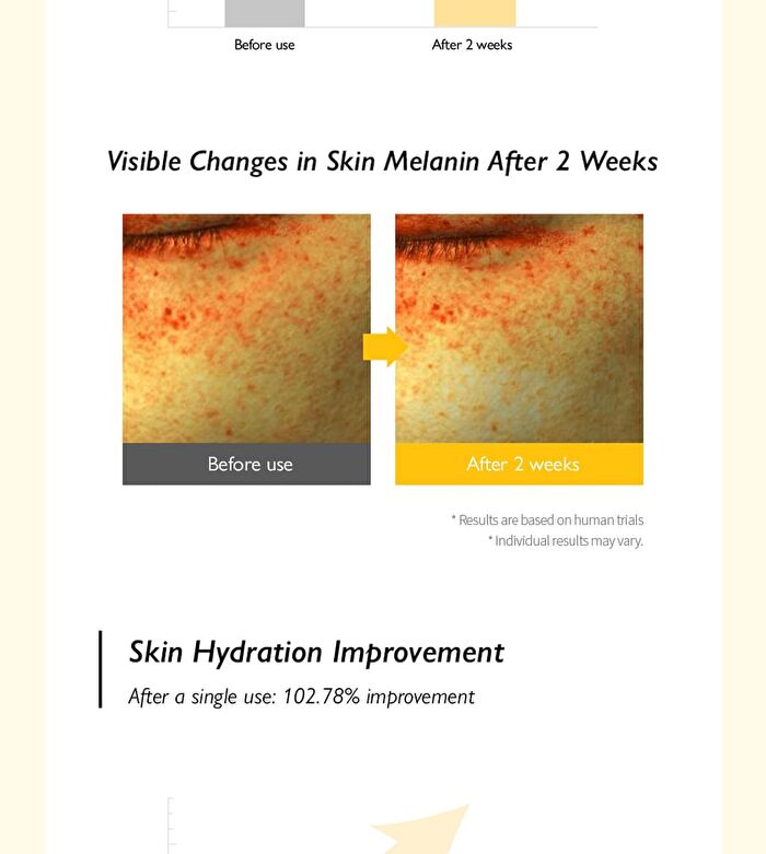 Glutathione Brightening Ampoule Mask Set - 25ml x 5 sheets