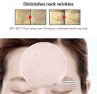 Botalinum Ampoule - 30ml