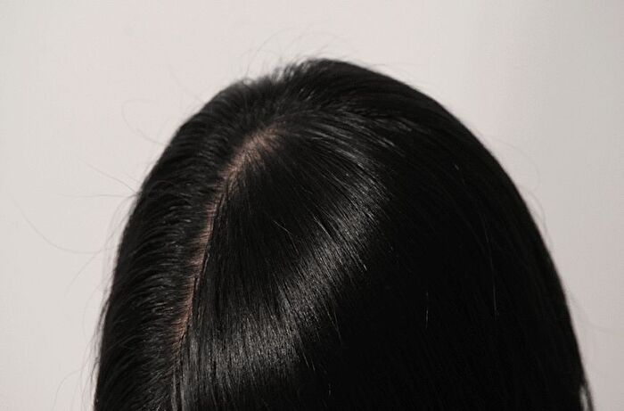 mixsoon Scalp & Hair Essence - 50ml