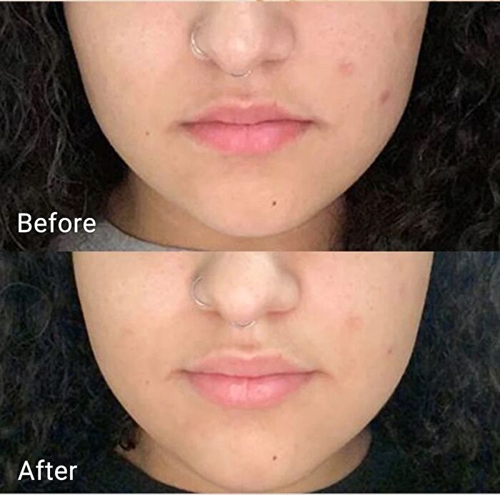 Aprilskin Real Calendula Peel Off Pack - 100g