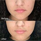 Aprilskin Real Calendula Peel Off Pack - 100g