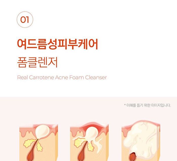 Aprilskin Real Carrotene Acne Foam Cleanser - 120ml