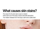 Anti-Melasma Cica Cream - 40ml