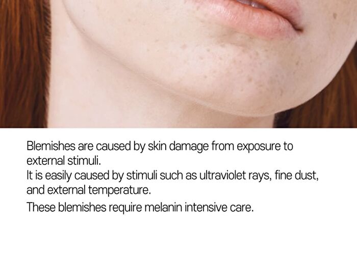 Anti-Melasma Cica Cream - 40ml