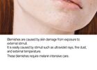 Anti-Melasma Cica Cream - 40ml