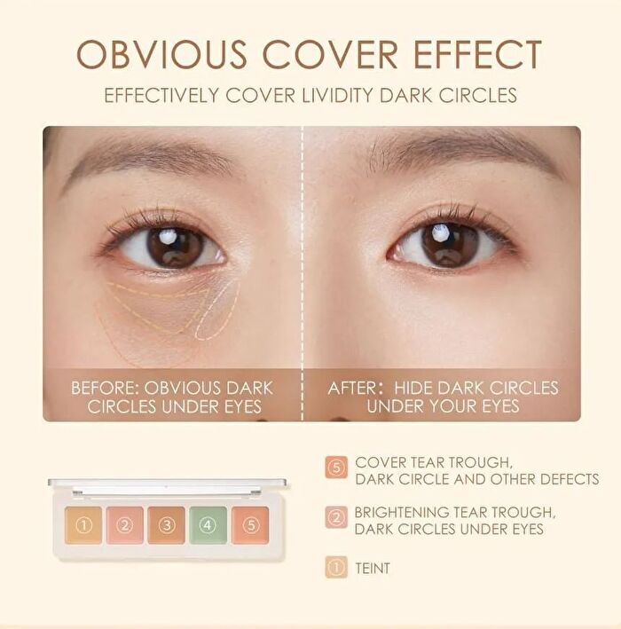 Focallure Color Correcting Concealer Palette - #1 - 4.3g