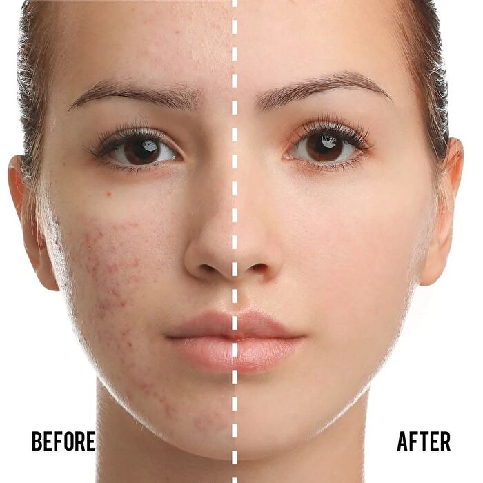 Catkin Summer Palace BB Moisture Cover BB Cream Cushion Foundation Set (#C01 Natural) - #C01 Natural - 13g*2