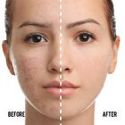 Catkin Summer Palace BB Moisture Cover BB Cream Cushion Foundation Set (#C01 Natural) - #C01 Natural - 13g*2