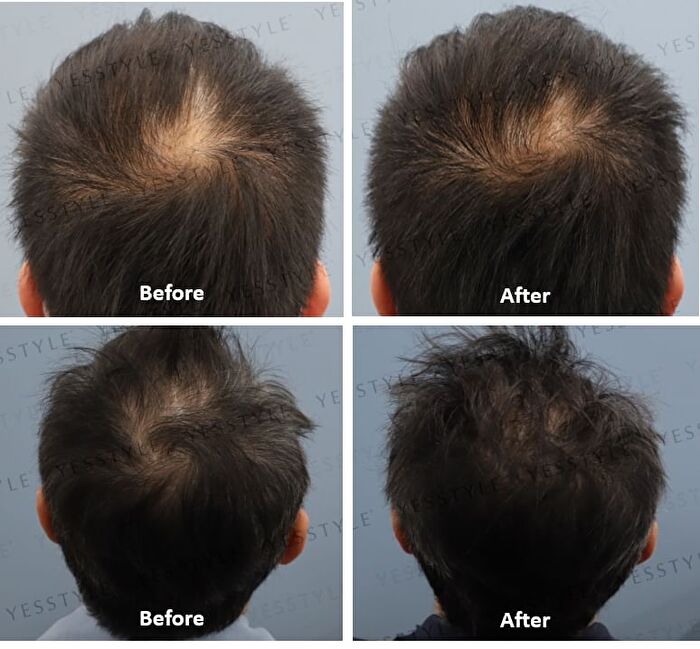 8 Hair Growth Agent - 60ml