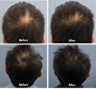 8 Hair Growth Agent - 60ml