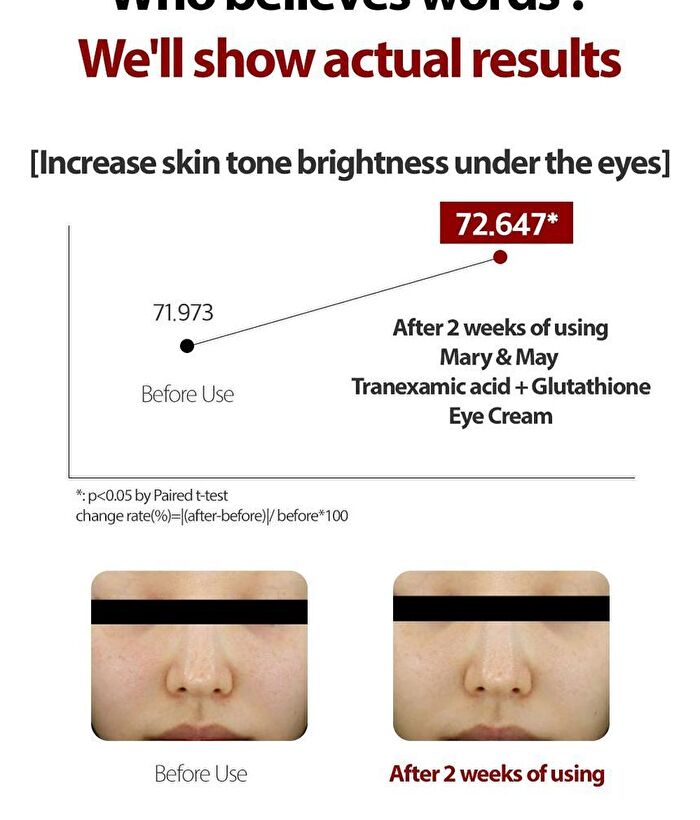 Tranexamic Acid + Glutathione Eye Cream Mini - 12g