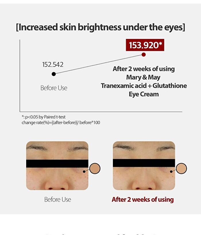 Tranexamic Acid + Glutathione Eye Cream Mini - 12g