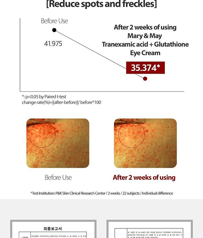 Tranexamic Acid + Glutathione Eye Cream Mini - 12g