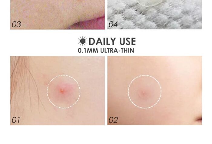 Focallure Acne Pimple Patch-Day & Night - #1 Day 24pcs