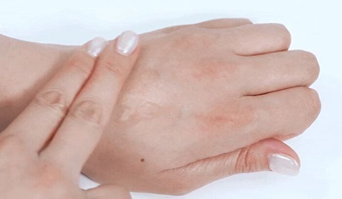 Cell Renew Snail Skin Treatment - 130ml