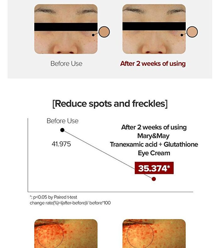 Glutathione Eye Cream Special Set - 3 pcs