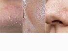 Carrotene IPMP Hydramelt Cleansing Balm - 90ml