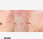 Aprilskin Carrotene IPMP Clearing Solution - 20ml