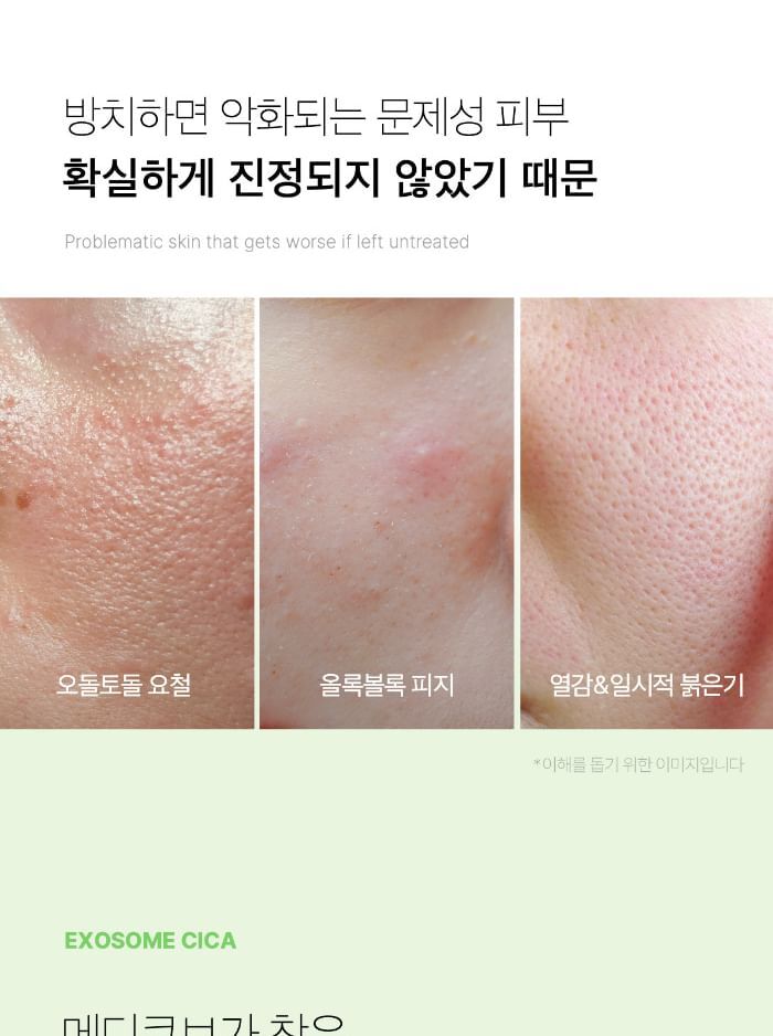 Exosome Cica Toner - 210ml