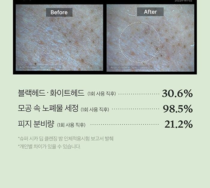 Super Cica Deep Cleansing Balm - 100ml