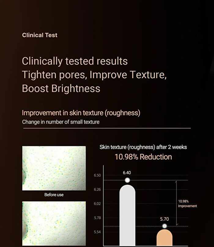 Aprilskin Calendula 10% PHA + AHA Resurfacing Serum - 2023 Version - 30ml