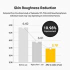 Aprilskin Calendula 10% PHA + AHA Resurfacing Serum - 2023 Version - 30ml