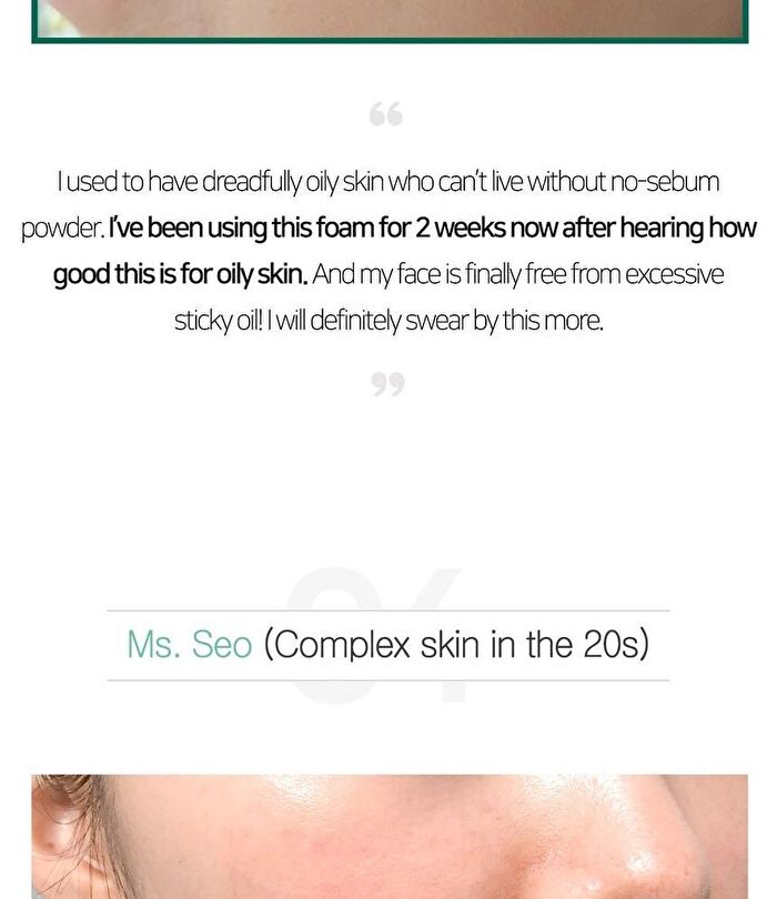 AHA,BHA,PHA 30 Days Miracle Acne Clear Foam Mini - 50ml