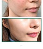 AHA,BHA,PHA 30 Days Miracle Acne Clear Foam Mini - 50ml