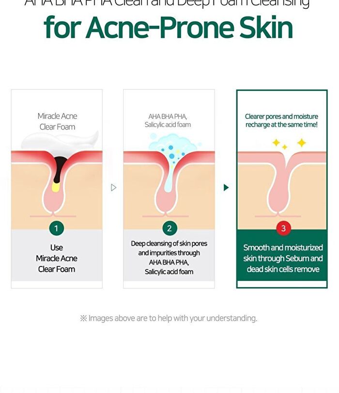 AHA,BHA,PHA 30 Days Miracle Acne Clear Foam Mini - 50ml
