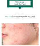 AHA,BHA,PHA 30 Days Miracle Acne Clear Foam Mini - 50ml