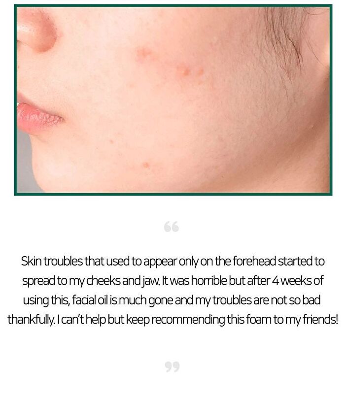 AHA,BHA,PHA 30 Days Miracle Acne Clear Foam Mini - 50ml