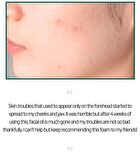 AHA,BHA,PHA 30 Days Miracle Acne Clear Foam Mini - 50ml