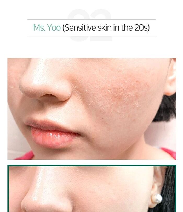 AHA,BHA,PHA 30 Days Miracle Acne Clear Foam Mini - 50ml