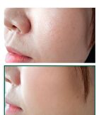 AHA,BHA,PHA 30 Days Miracle Acne Clear Foam Mini - 50ml