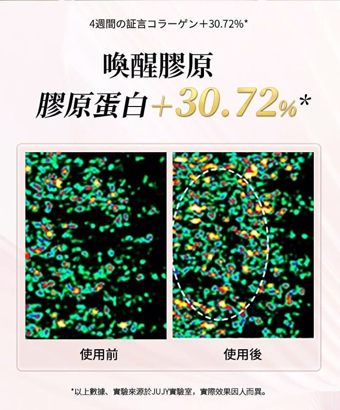 Collagen Revitalizing RF Device Pro - 1 Set